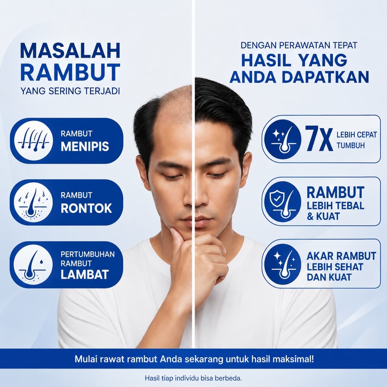 Perawatan Rambut Menipis & Rontok di Usia 30+ — Rawat Kembali dari Akarnya